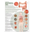 Image for Understanding Inflammatory Bowel Disease (IBD) Anatomical Chart