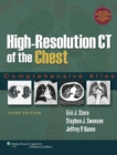 Image for High-resolution CT of the chest  : comprehensive atlas