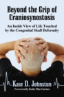 Image for Beyond the Grip of Craniosynostosis : An Inside View of Life Touched by the Congenital Skull Deformity