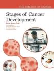 Image for Stages of Cancer Development