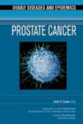 Image for Prostate Cancer