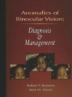 Image for Anomalies Of Binocular Vision : Diagnosis And Management