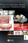 Image for Clinical and Laboratory Manual of Implant Overdentures