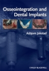 Image for Osseointegration and Dental Implants