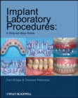 Image for Implant laboratory procedures: a step by step guide