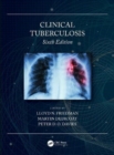 Image for Clinical tuberculosis