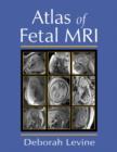 Image for Atlas of Fetal MRI