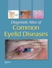 Image for Diagnostic ttlas of common eyelid diseases