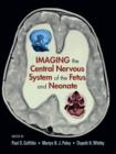 Image for Imaging the central nervous system of the fetus and neonate