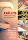 Image for Cellulite Pathophysiology