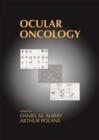 Image for Ocular oncology