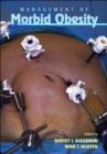 Image for Management of Morbid Obesity