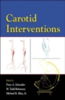 Image for Carotid Interventions
