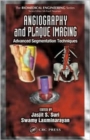 Image for Angiography and plaque imaging  : advanced segmentation techniques