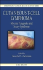 Image for Cutaneous T-Cell Lymphoma