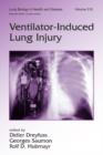 Image for Ventilator-Induced Lung Injury