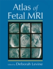 Image for Atlas of fetal MRI