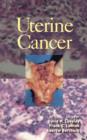 Image for Uterine cancer