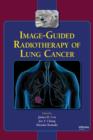Image for Image-guided radiotherapy of lung cancer