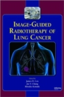 Image for Image-Guided Radiotherapy of Lung Cancer