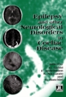 Image for Epilepsy &amp; Other Neurological Disorders in Coeliac Disease