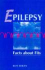 Image for Epilepsy  : facts about fits