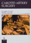 Image for Carotid Artery Surgery