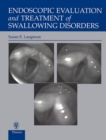 Image for Endoscopic Evaluation and Treatment of Swallowing Disorders