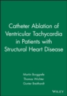 Image for Catheter Ablation of Ventricular Tachycardia in Patients with Structural Heart Disease