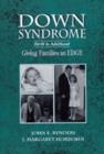 Image for Down Syndrome: Birth to Adulthood