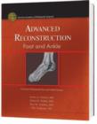 Image for Advanced Reconstruction: Foot and Ankle