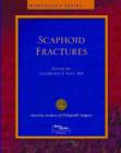 Image for Scaphoid Fractures