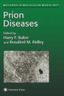 Image for Prion Diseases