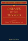 Image for Diseases of the thyroid
