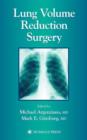 Image for Lung volume reduction surgery