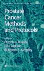 Image for Prostate cancer  : methods and protocols