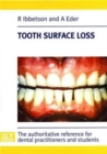 Image for Tooth Surface Loss