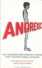 Image for Anorexic  : a true story