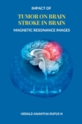 Image for Impact of Tumor on Brain Stroke in Brain Magnetic Resonance Images