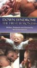 Image for Down Syndrome : The First 18 Months