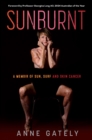 Image for SUNBURNT: A memoir of sun, surf and skin cancer