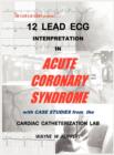 Image for 12 Lead ECG Interpretation in Acute Coronary Syndrome with Case Studies from the Cardiac Catheterization Lab
