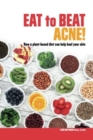 Image for Eat to Beat Acne!