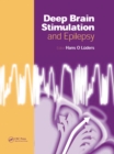 Image for Deep Brain Stimulation and Epilepsy
