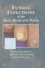 Image for Fungal infections of the skin and nails