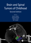 Image for Brain and Spinal Tumors of Childhood