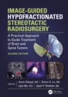 Image for Image-Guided Hypofractionated Stereotactic Radiosurgery: A Practical Approach to Guide Treatment of Brain and Spine Tumors