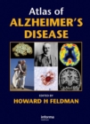 Image for Atlas of Alzheimer&#39;s Disease