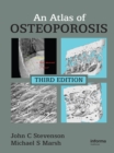 Image for An Atlas of Osteoporosis