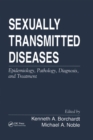 Image for Sexually Transmitted Diseases: Epidemiology, Pathology, Diagnosis, and Treatment
